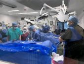 عميد طب قصر العينى: عملية استئصال جهاز منظم ضربات القلب المصاب وملحقاته نادرة