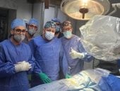 نجاح عملية نادرة لطفل عمره 3 سنوات بـ"طب الأزهر" فى دمياط.. التفاصيل