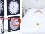 شابة تفقد قدرتها على التحدث بالإنجليزية بعد إتقانها تثير حيرة الأطباء