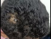 معجزة.. أطباء الفيوم الجامعى يستخرجون مسمارا اخترق رأس طفل 