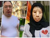 يعيشون شبه حياة.. سائل الأسيد الحارق "ماء النار" يدمر مستقبل ضحاياه.. يتركهم للتشوهات أو الوفاة.. أقصى عقوبة للجانى تصل لـ10 سنوات فقط.. والمعتدى عليهم: حياتنا انتهت وتشوهت ملامحنا ولابد من تشريع رادع للجناة