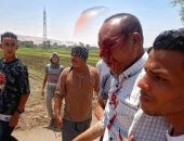 التقرير الطبى للموظف المعتدى عليه بسوهاج: انفجار مفرغ فى مقلة العين اليسرى