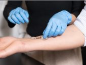 تطوير ضمادة ذكية تتعقب الجروح المزمنة وتعالجها 