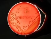 اكتشاف بكتيريا قادرة على التظاهر بالموت حتى فى بيئة معقمة.. اعرف التفاصيل