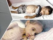 غزة بين الجوع والنار..أجساد منهكة وعظام بارزة.. شهادات من داخل القطاع توثق الكارثة.. عدى ومحمد شقيقان يفارقان الحياة بسبب المجاعة.. فادي النجار مات بعد فقد 50% من وزنه..أم تعرض ألعاب أطفالها للبيع مقابل الدقيق