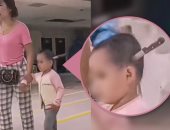 صور لسكين مغروس في جمجمة طفلة تثير الفزع.. والأم تصطحبها بـ هدوء للمستشفى