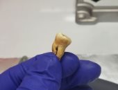 حمض نووي يكشف المسئول عن أول وباء في العالم.. اعرف القصة