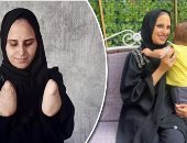 الاحتلال يقضى على أحلام "نبال الهسى".. قذيفة تستهدف خيمتها وتتسبب فى بتر يديها وتحرمها من احتضان ابنتها الرضيعة.. زوجها ينفصل عنها ويتركها مشردة مع والديها المسنين.. والأطباء يعجزون عن توفير أطراف صناعية لها