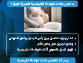 ما حالات الولادة القيصرية المبررة طبيا؟.. وزارة الصحة تجيب