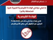 وزارة الصحة توضح دواعى إجراء الولادات القيصرية المبررة طبيا