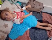 الرضيعة مريم أبو مصطفى ولدت في غزة أثناء الحرب وإعاقة دماغية تهدد حياتها