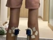 مراهق ينفق ألفى دولار على جلسات زيادة الطول ثم يخسر 1.4 سم بعد أسبوعين