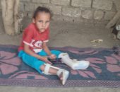 ريتاج طفلة من سوهاج تصارع مرض ضمور العضلات وتحتاج حقنة بـ40 مليون جنيه