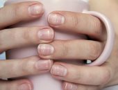 كيف تكشف الأظافر عن مشاكلك الصحية؟