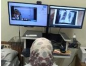 الصحة: توزيع 2152 مولد أكسجين على مرضى التليف الرئوي بنظام العلاج المنزلي