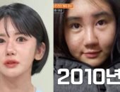 كورية جنوبية تجرى 400 عملية تجميل خلال 15 عاما