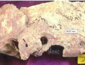جماجم قديمة تكشف عن إجراء عمليات جراحية فى المخ خلال العصر البيزنطى 