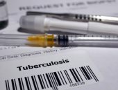 تعرف على أعراض الإصابة بمرض السل وازاى تفرق بينها وبين كورونا والانفلونزا