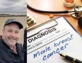 رجل أمريكى يشخص بسرطان الثدي العدواني بعد تجاهل الأعراض