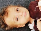 حياة الطفلين محمد وأميرة مهددة فى ظل نقص الغذاء والأدوية داخل غزة.. صور