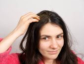 وصفات طبيعية للتخلص من قشرة الرأس الدهنية.. القهوة الأبرز