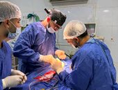 جراحة نادرة بالشرقية لاستخراج توأم من صدر رضيع عمره 10 أيام.. صور