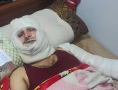 ضبط المتهمين بإشعال النيران فى شخص أمام زوجته وإصابته بحروق خطيرة.. صور