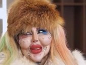 إنفلونسر تثير الجدل بعد 388 عملية تجميل وتصرح: الجوهر أهم من الشكل.. صور