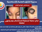 نجاح عملية تجميلية لإزالة ورم ملون ومشعر من وجه طفلة بمستشفى أبوقير العام