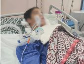 إهمال جديد فى حمامات السباحة.. شاب يدخل العناية بين الحياة والموت (فيديو)