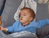 عينان مغمضتان وجسد منهك.. قصة معاناة مسك العديني تختصر وجع أطفال غزة.. صور