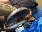 فريق طبى ينجح فى استخراج منشار كهربى استقر فى بطن طفل بدمياط