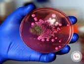تفشى بكتيريا كانديدا أوريس المقاومة لجميع أنواع المضادات الحيوية في أمريكا