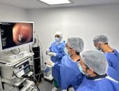 «مدكور تكنيك».. طفرة طبية فى علاج مرض نادر ببورسعيد.. تطوير جديد لعلاج «الأكاليزيا».. إجراء أكثر من 2000 حالة ضمن التأمين الصحى الشامل.. والدكتور أحمد حسن: الوحدة تكلفت أكثر من 50 مليون جنيه.. فيديو وصور