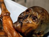 مومياء أوتزى تكشف أسراراً عمرها 5000 عام حول فيروس الورم الحليمى