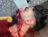 القبض على المتهمين بالاعتداء على شاب والشروع في قتله بالشرابية.. صور