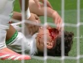 نهائي كأس أمم إفريقيا.. إصابة دموية تضرب نائل العيناوى نجم منتخب المغرب