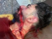 شقيق ضحية الشرابية: الجناة اعتدوا عليه بأسلحة بيضاء في الشارع.. صور