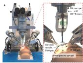 صحتك بالدنيا.. روبوت جديد لجراحات العين ونصائح للوقاية من السكر 