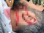 إصابة نجار موبيليا بجروح قطعية بعد تعدى 4 أشخاص عليه فى طوخ.. صور