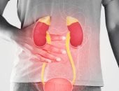 هذا النظام الغذائى يقلل من خطر الإصابة بأمراض الكلى