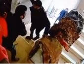 ننشر التقرير الطبى لتشويه وجه سيدة بيد زوجها لرغبتها فى الخلع بالعجوزة