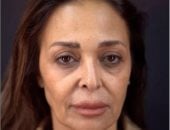 داليا البحيرى تفاجئ جمهورها بعد عمليتها الأخيرة: كانوا بيقولوا إنتى تعبانة