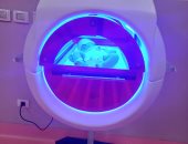 الكبسولة الضوئية تستقبل أول رضيع مصاب بالصفراء بمستشفى العاشر من رمضان الجامعى