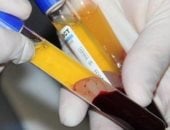 القانون يضع شروطا للتبرع بالدم أو البلازما.. وعقوبات مشددة للمخالفين