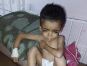 بعد وفاة شقيقه بالمرض ذاته.. ياسر عرفات يصارع سوء التغذية والسيلياك في غزة