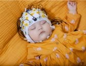 علاقة قوية بين اضطرابات النوم لدى الرضع واحتمالية الاصابة بالتوحد