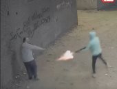 حقيقة بتـر قدم طفل باسوس المصاب بطلق خرطوش فى القليوبية.. فيديو