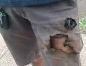 لعبة القدر.. نجاة رجل برازيلى من هجوم كلبين بعد انفجار الهاتف فى جيبه