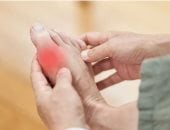 مرض الملوك نوع من التهاب المفاصل يسبب الألم.. شرب الماء ضرورى لتجنبه